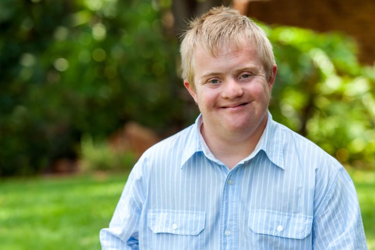Handsome Down Syndrome Young Adult